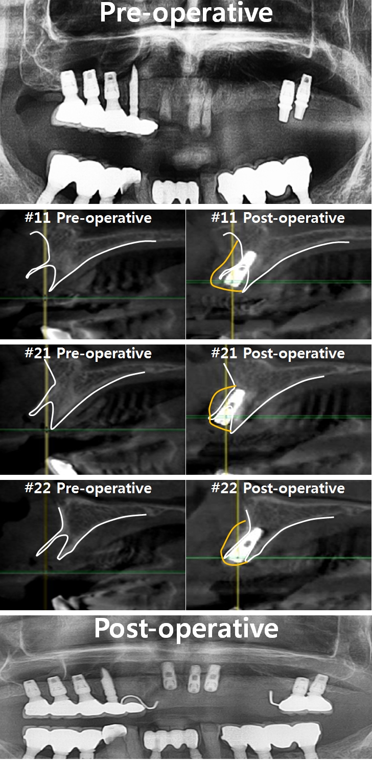 procedure.jpg