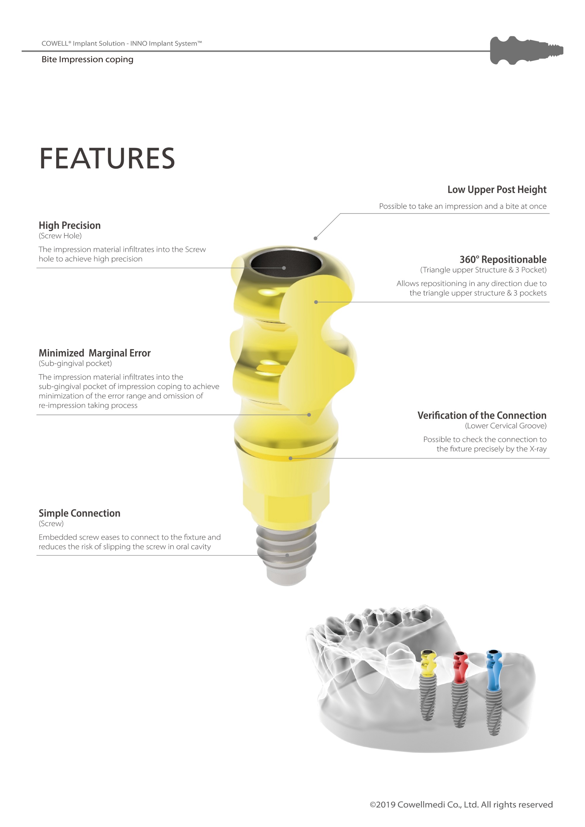 Bite Impression Coping Catalog(HD)-4.jpg