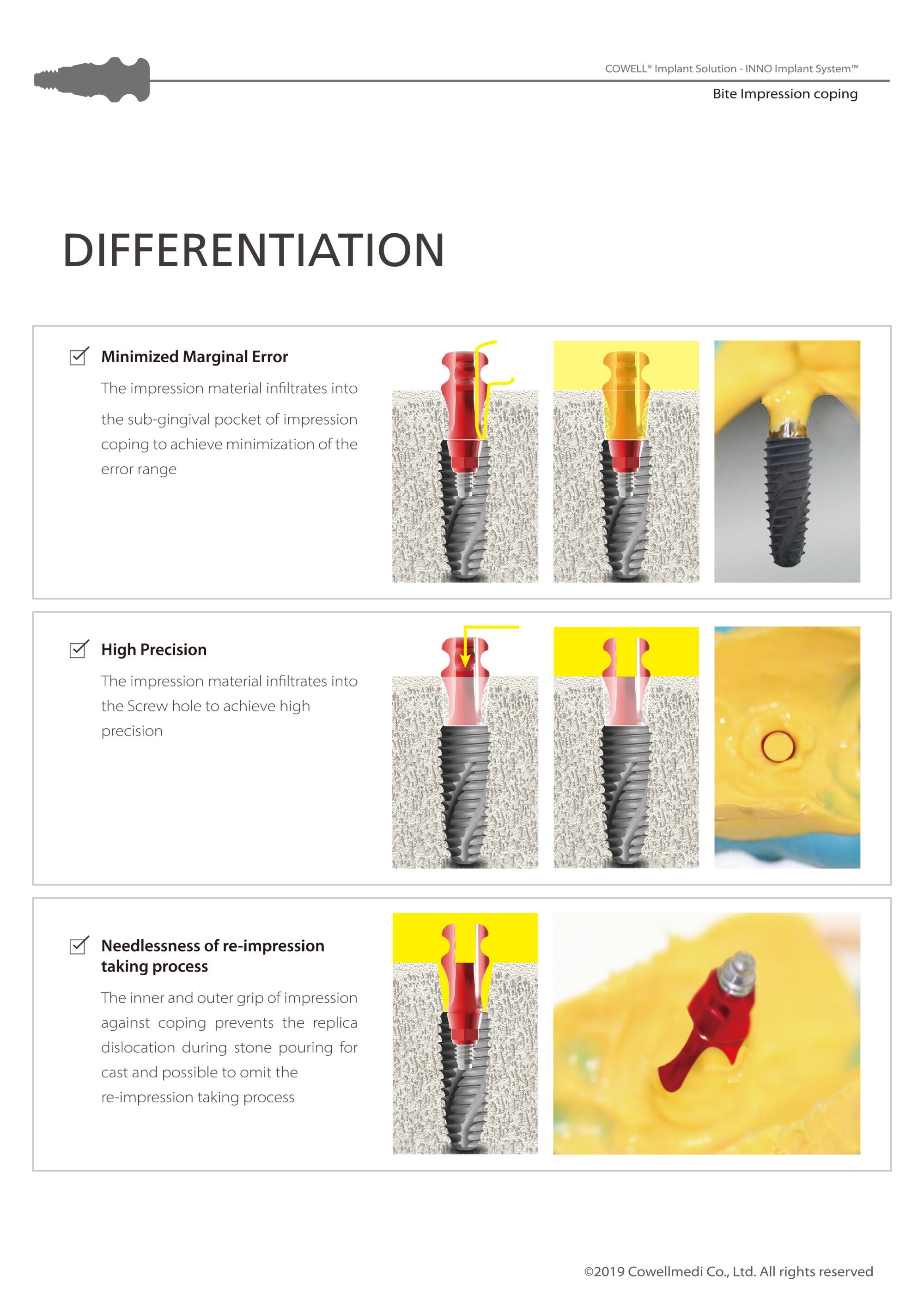 Bite Impression Coping Catalog(HD)-5.jpg