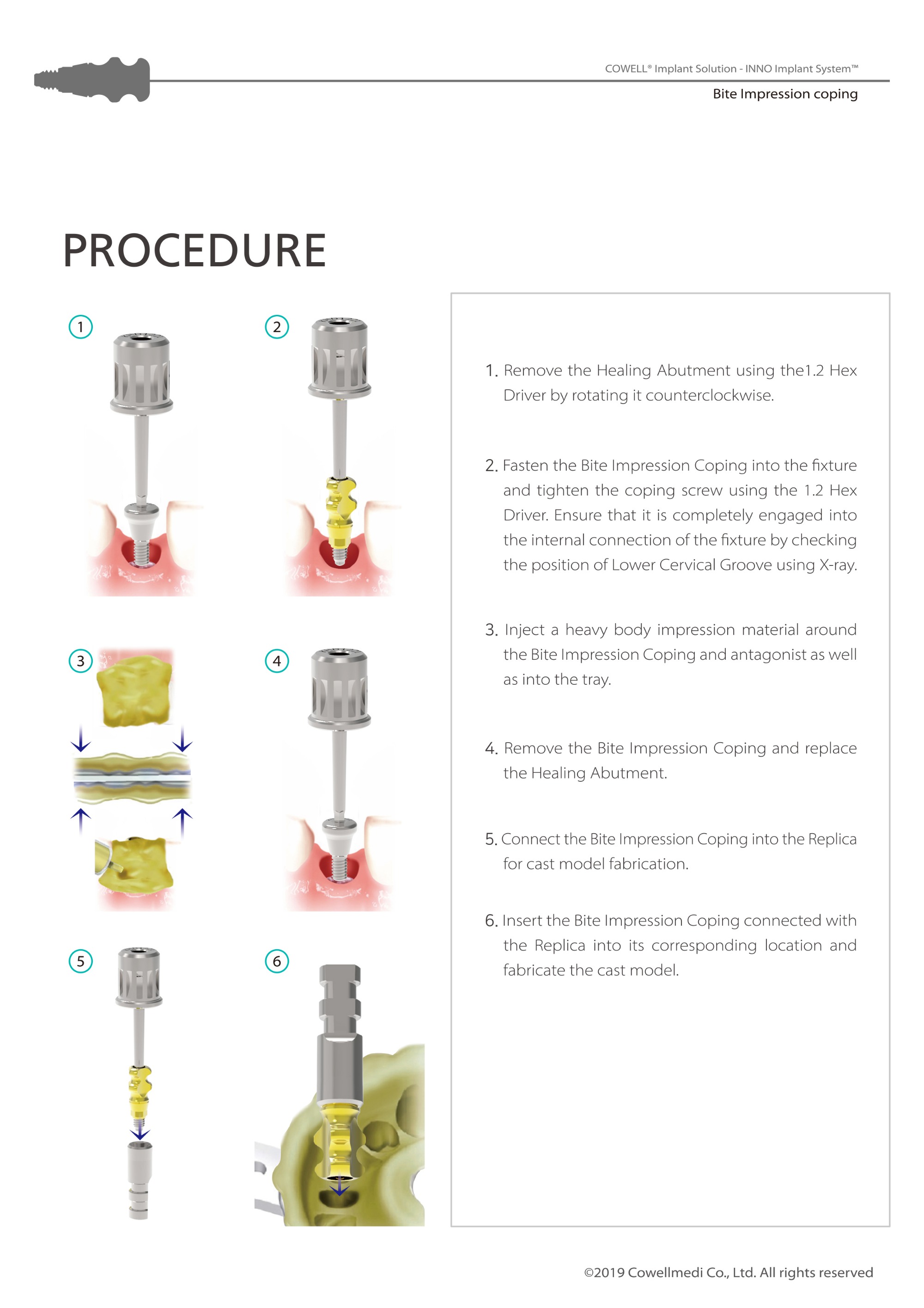 Bite Impression Coping Catalog(HD)-7.jpg