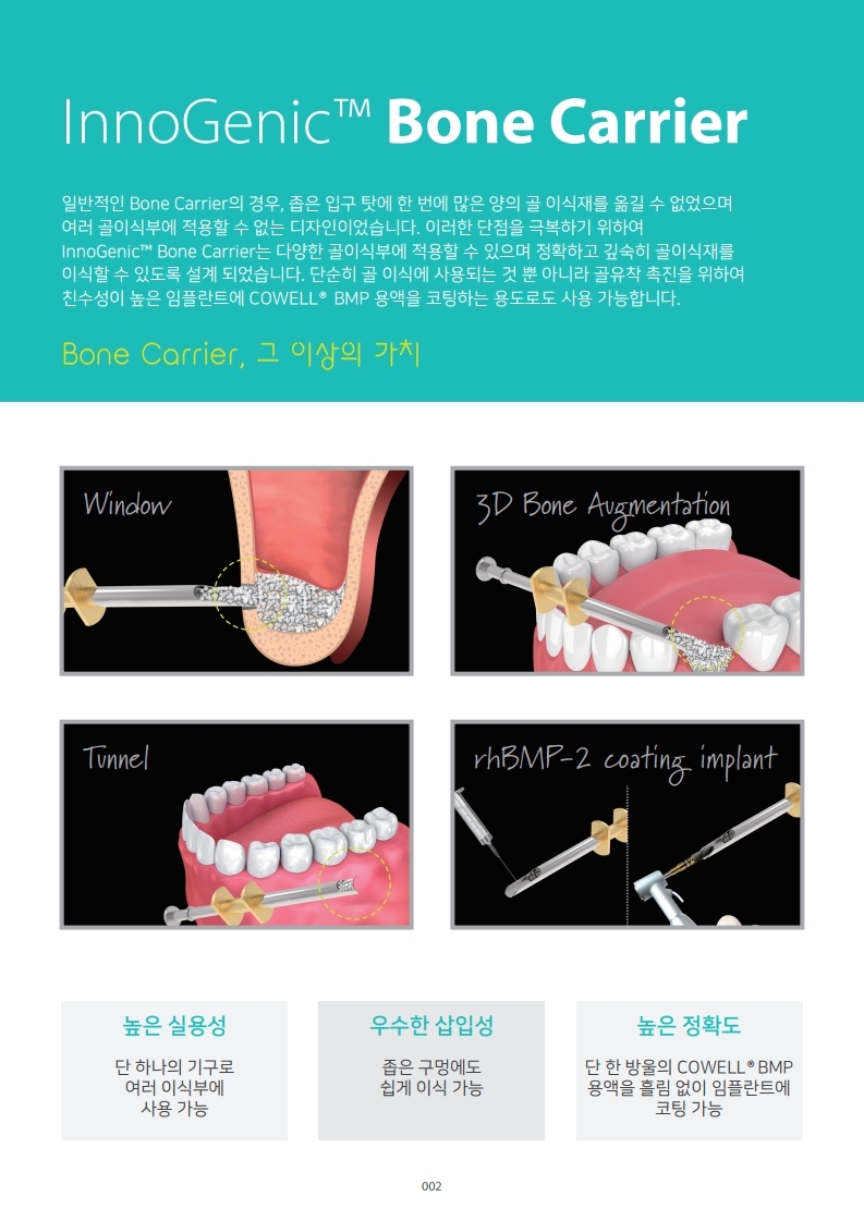 InnoGenic™ Bone Carrier_Kor.pdf_page_2.jpg