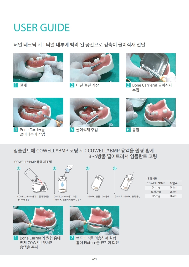 InnoGenic™ Bone Carrier_Kor.pdf_page_5.jpg